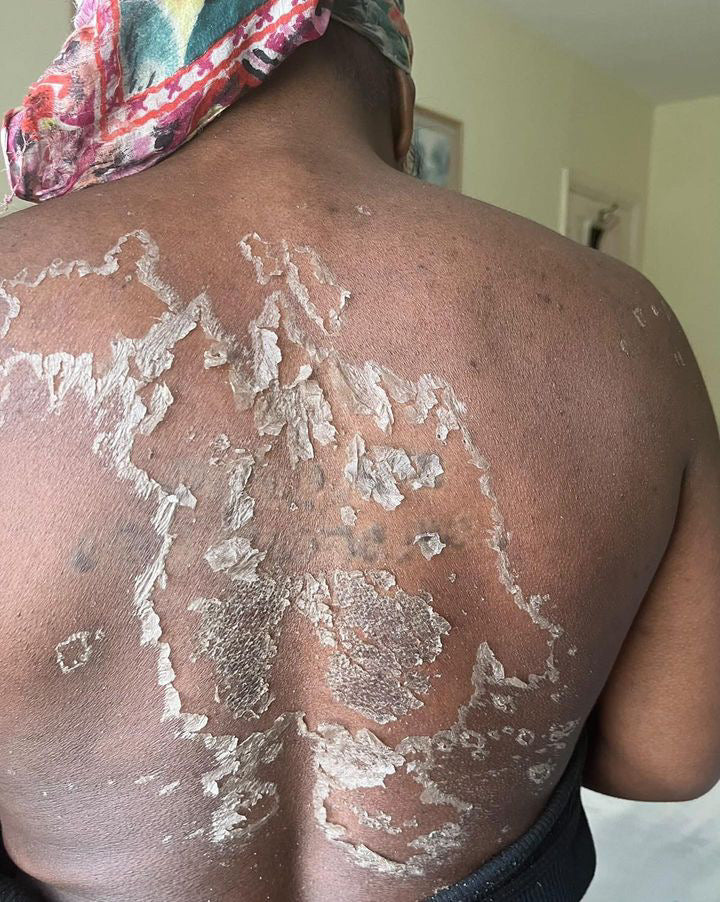 Treatment View
