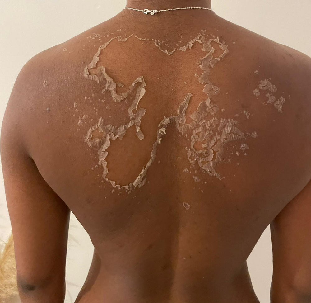 Herbal Corrective Skincare