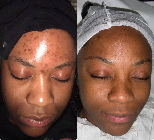 Skin Transformation Result
