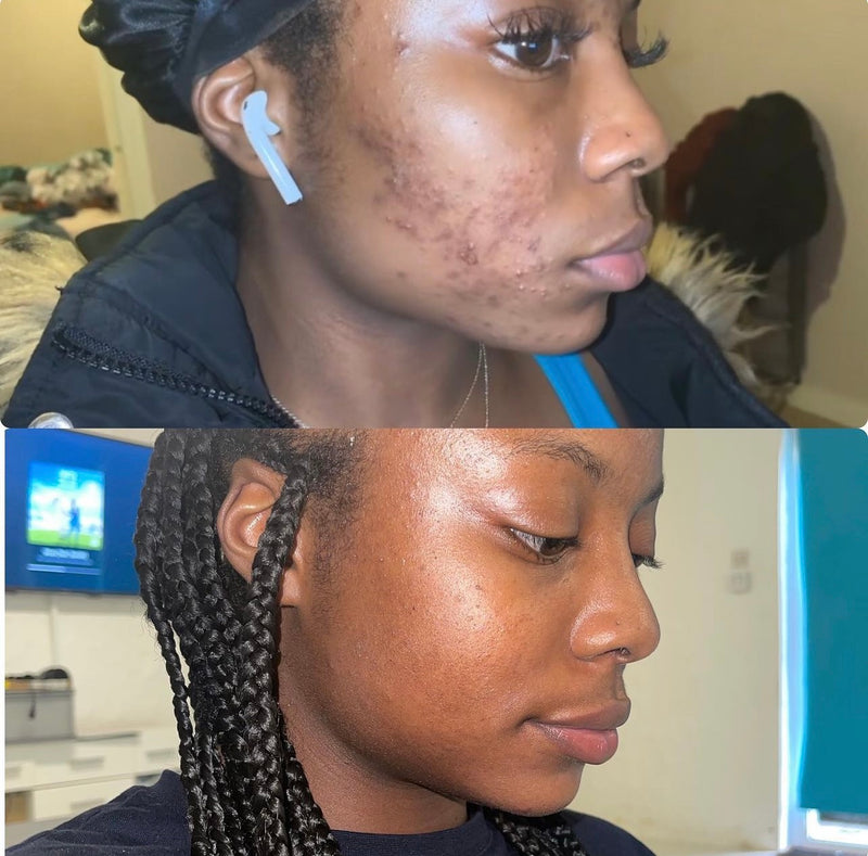 Treatment Result