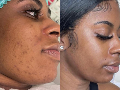 Skin Transformation Result
