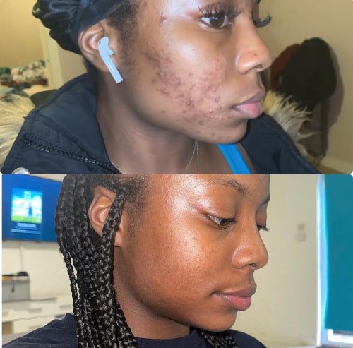 Skin Transformation Result