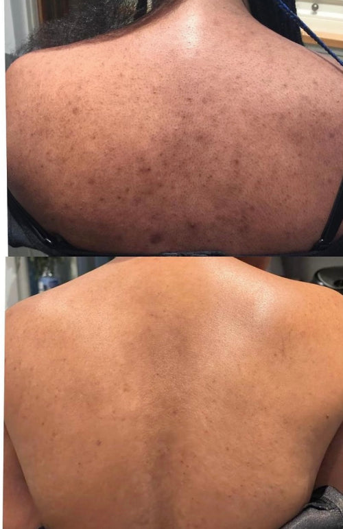 Skin Transformation Result