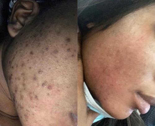 Skin Transformation Result