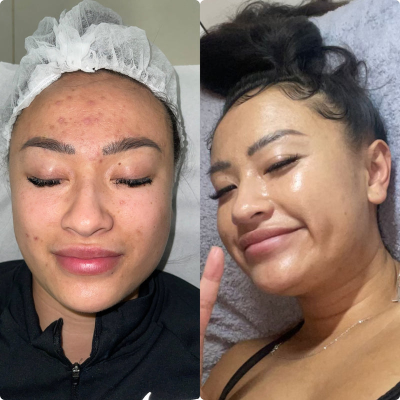 Treatment Result