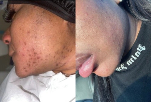 Skin Transformation Result