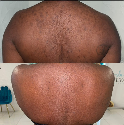 Skin Transformation Result