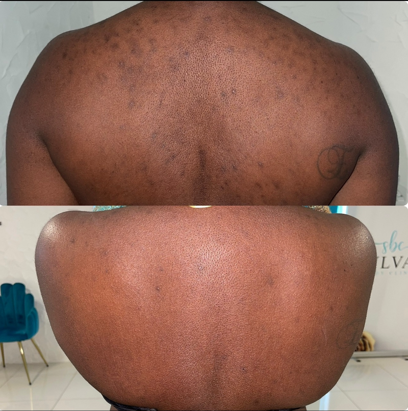 Treatment Result