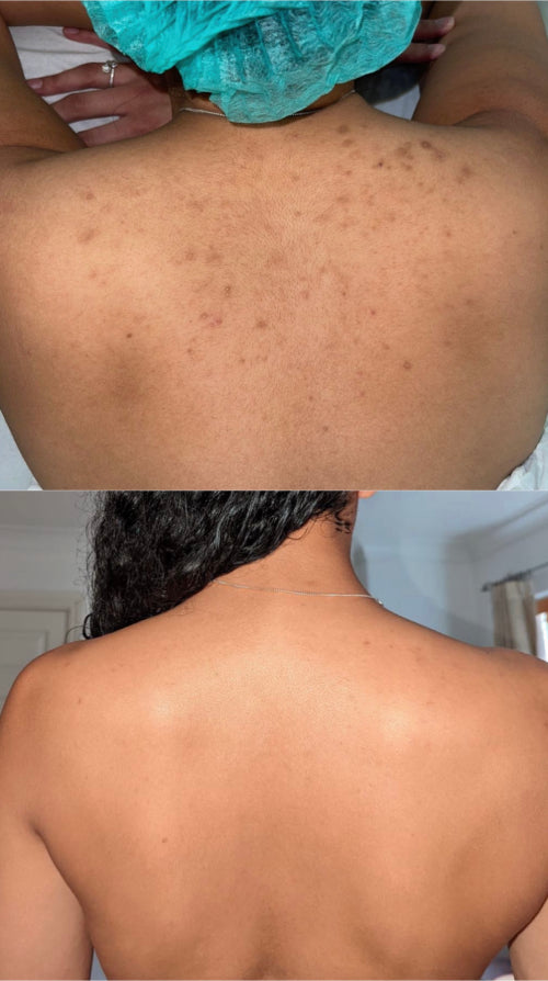 Skin Transformation Result