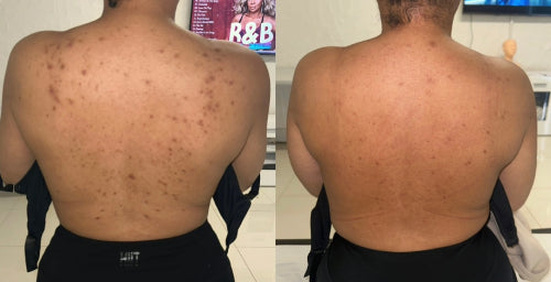 Skin Transformation Result