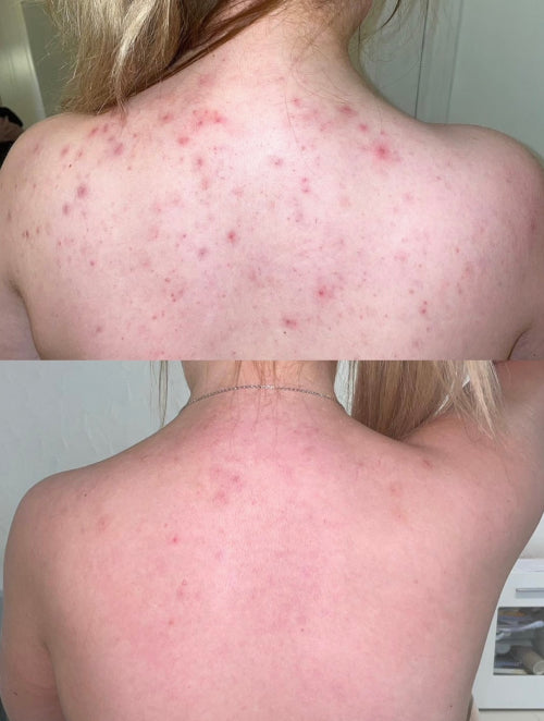 Skin Transformation Result