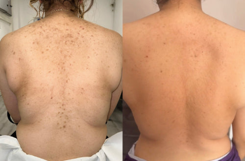 Skin Transformation Result