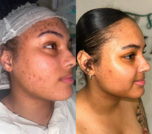 Skin Transformation Result