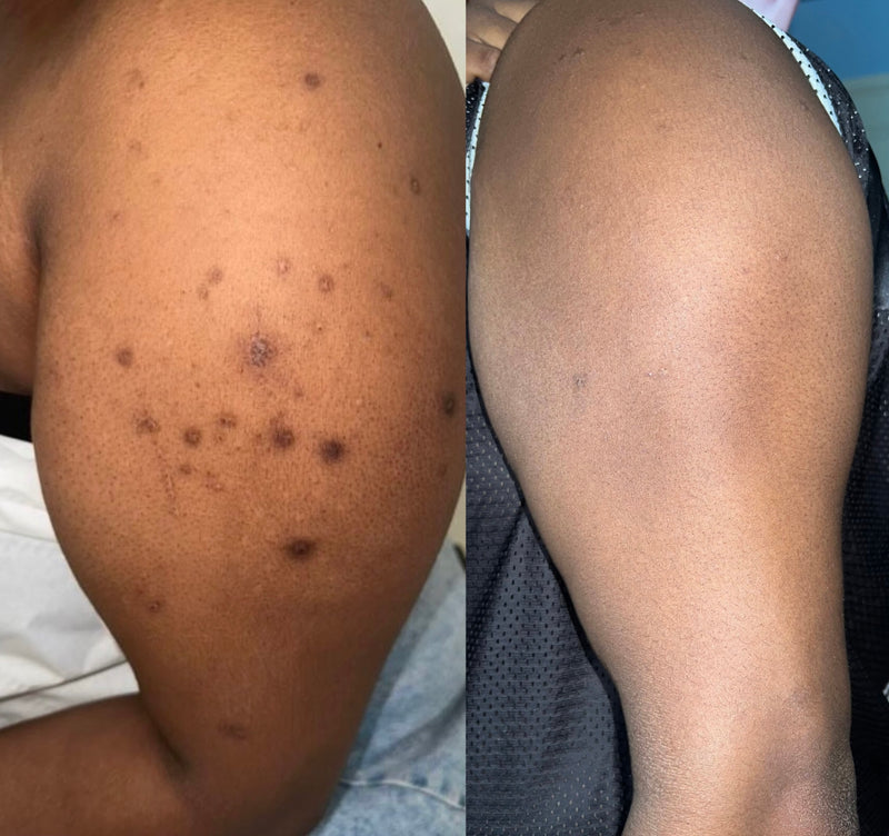 Treatment Result