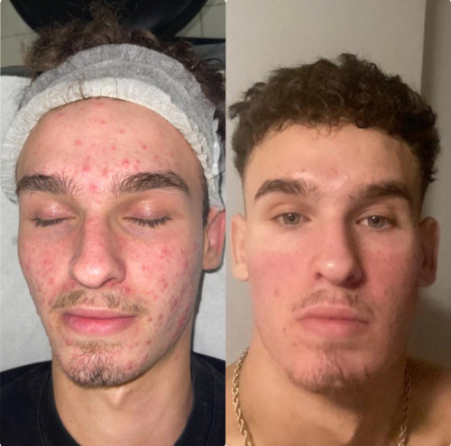 Skin Transformation Result