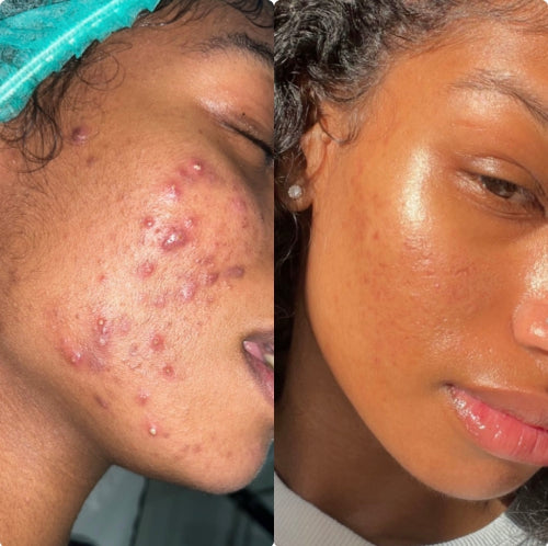 Skin Transformation Result