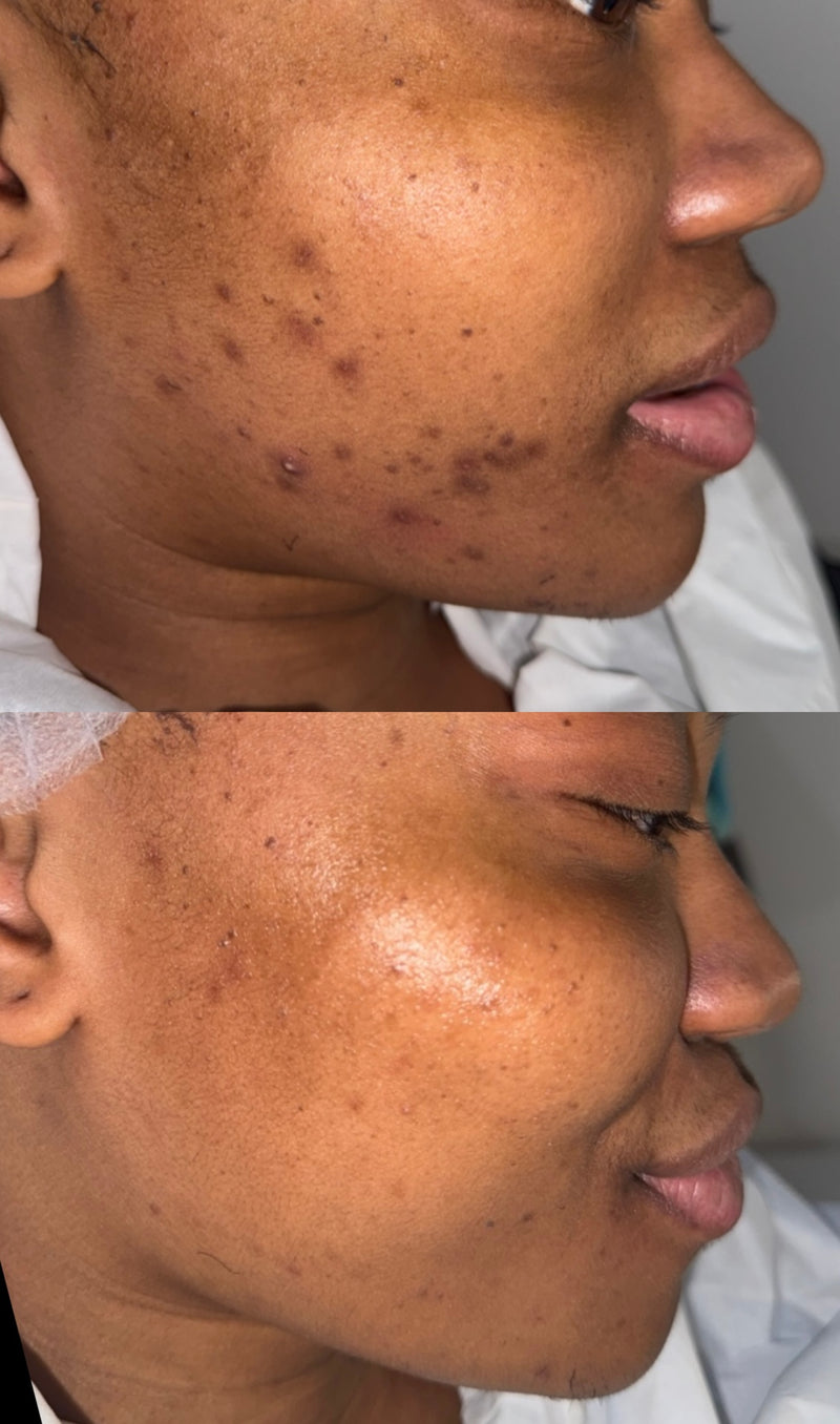Treatment Result