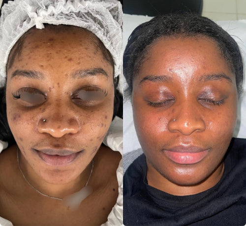 Skin Transformation Result