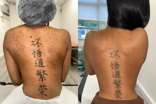 Skin Transformation Result