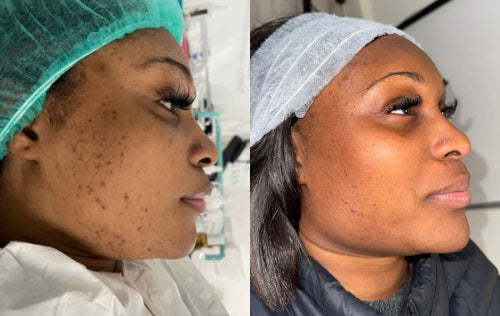 Skin Transformation Result