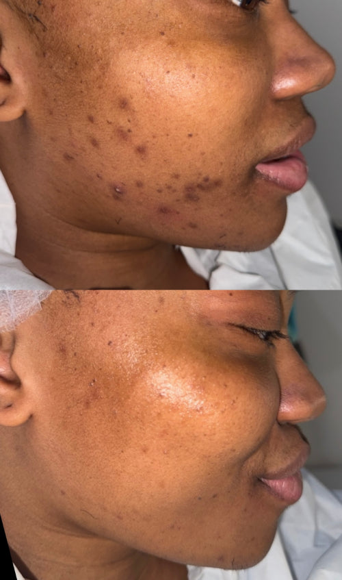 Skin Transformation Result