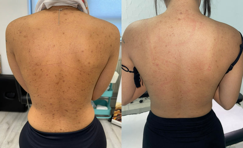 Treatment Result