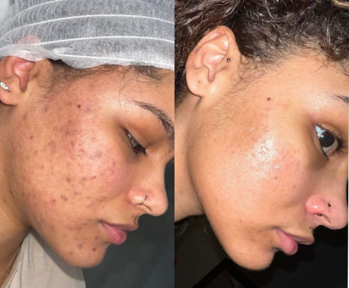 Skin Transformation Result