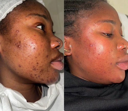 Skin Transformation Result