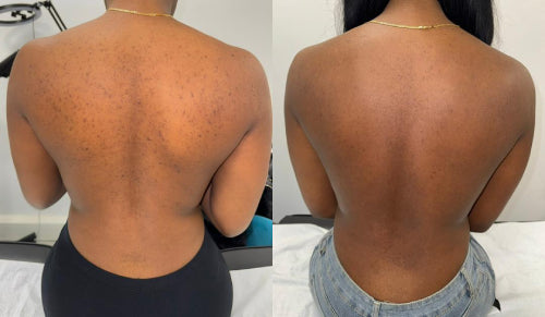 Skin Transformation Result