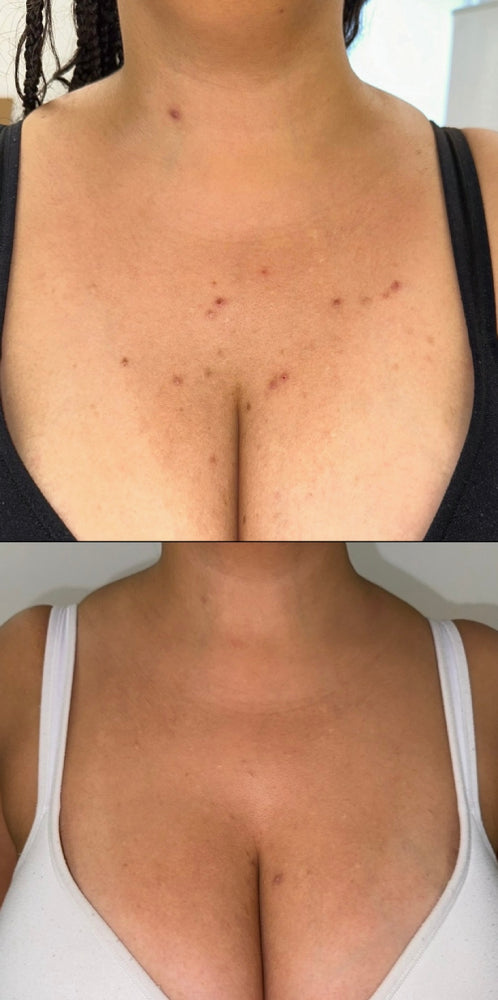 Skin Transformation Result