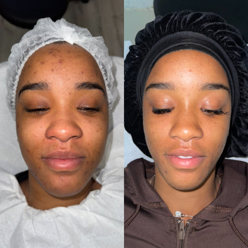 Skin Transformation Result