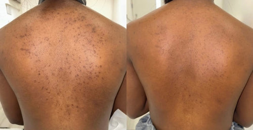 Skin Transformation Result