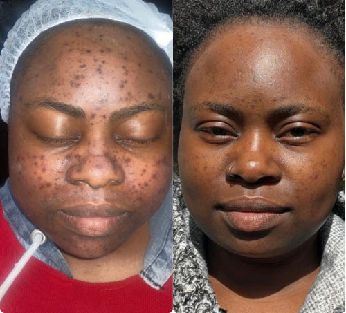 Skin Transformation Result