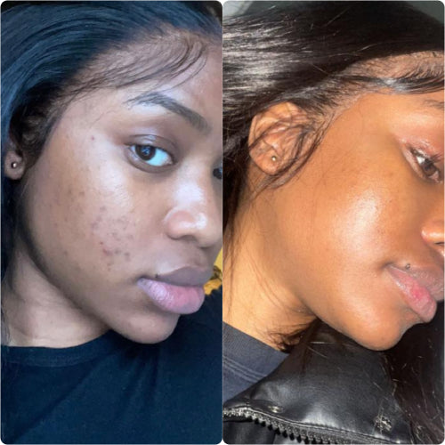 Skin Transformation Result