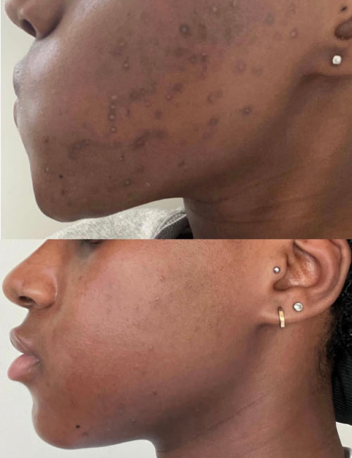 Skin Transformation Result
