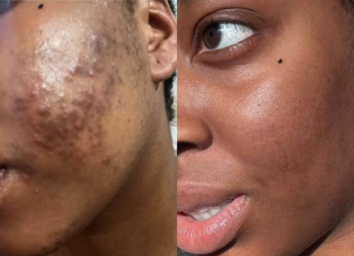 Skin Transformation Result