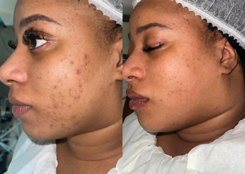 Skin Transformation Result