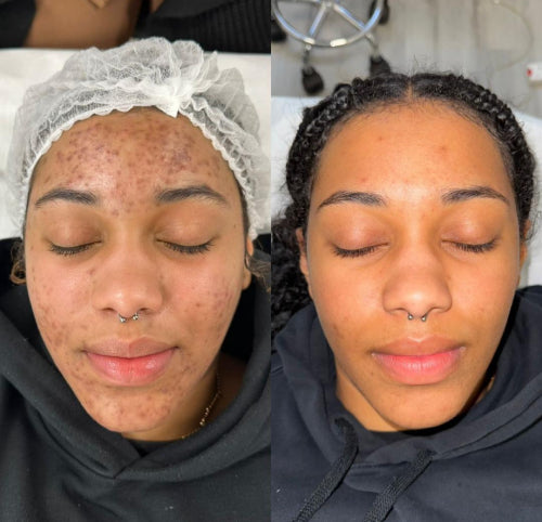 Skin Transformation Result