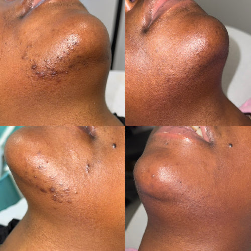 Skin Transformation Result