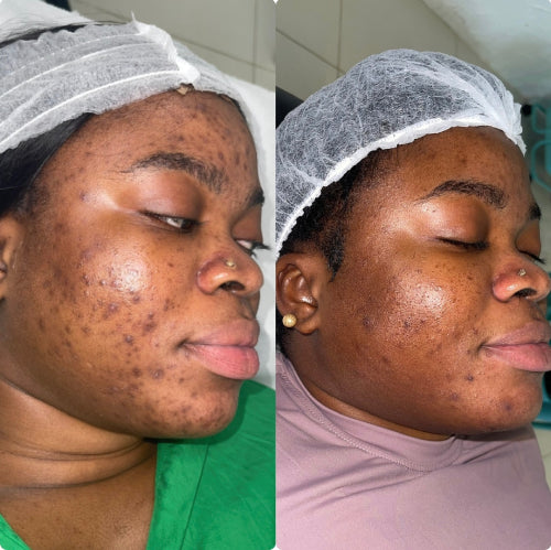Skin Transformation Result
