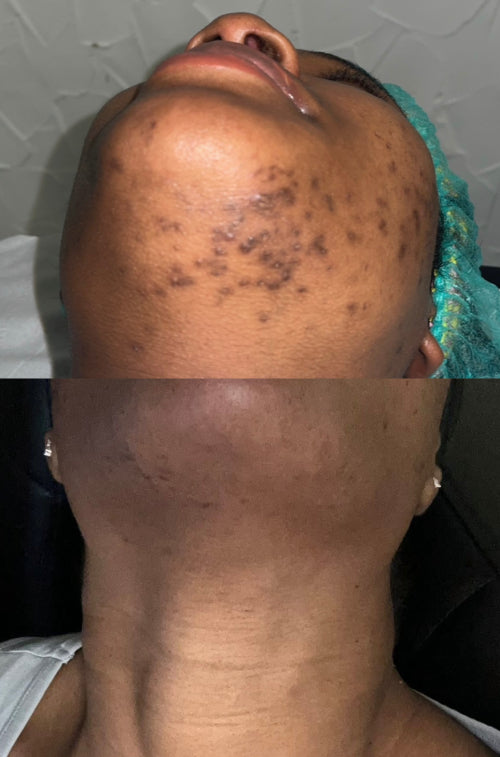 Skin Transformation Result