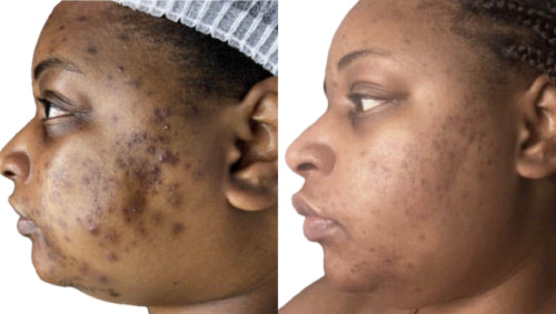 Skin Transformation Result