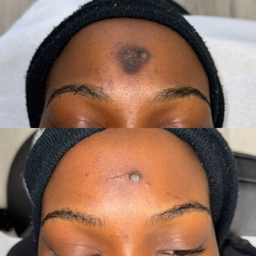 Skin Transformation Result