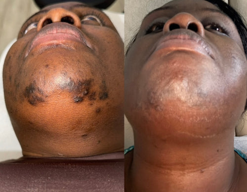 Skin Transformation Result