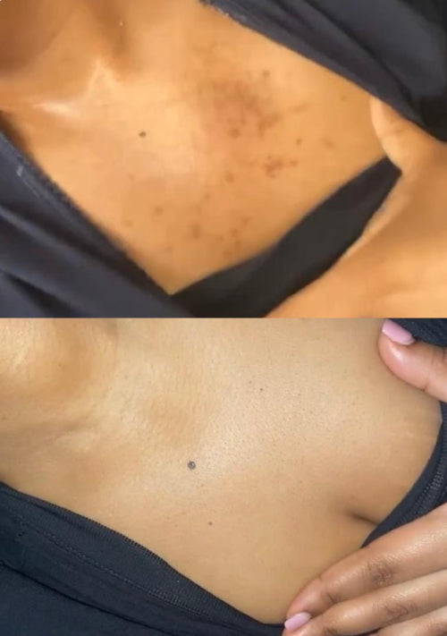 Skin Transformation Result