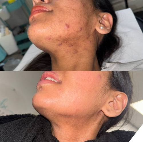 Skin Transformation Result