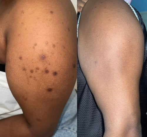 Skin Transformation Result