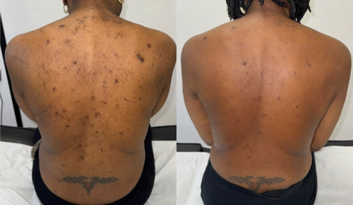 Skin Transformation Result