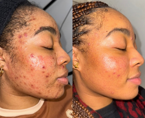 Skin Transformation Result