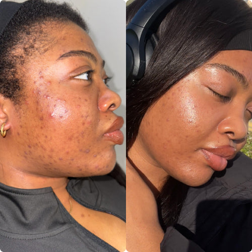 Skin Transformation Result